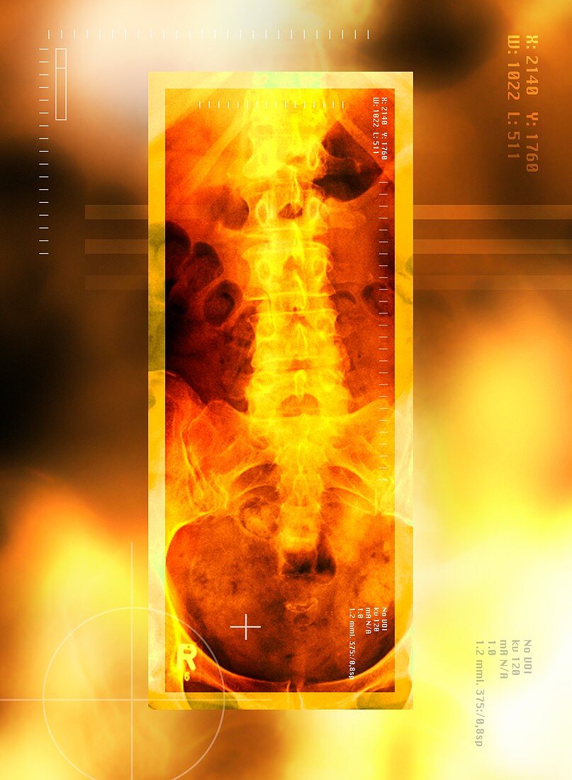 Healthy lower back,X-ray