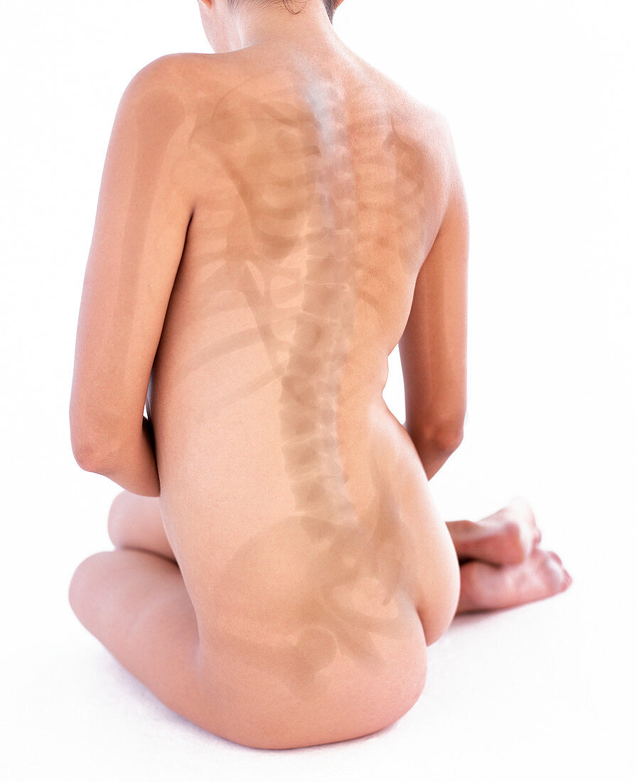 Spinal column