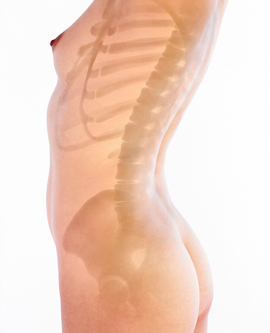 Woman's spine