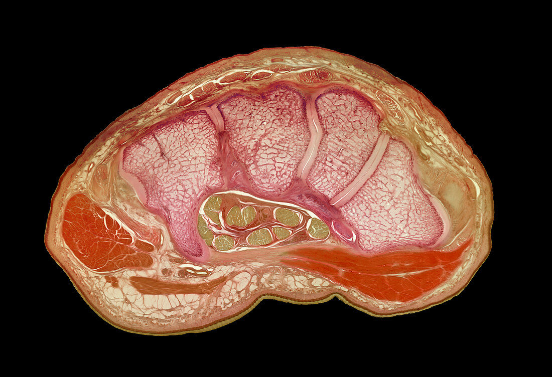 Wrist anatomy
