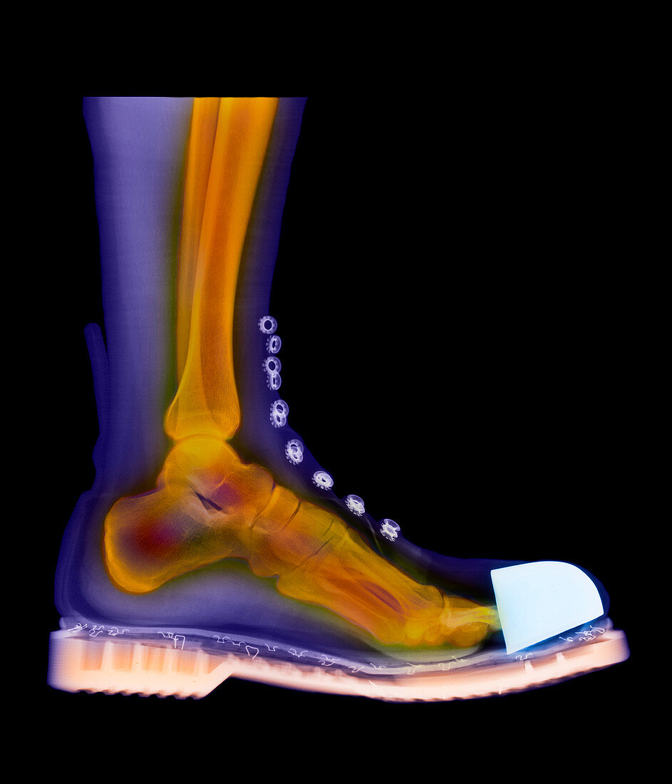 Coloured X-ray of man's foot in a Doc Marten boot