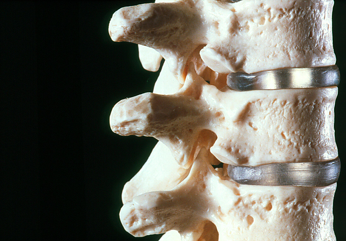 Model of three vertebrae and intervertebral discs
