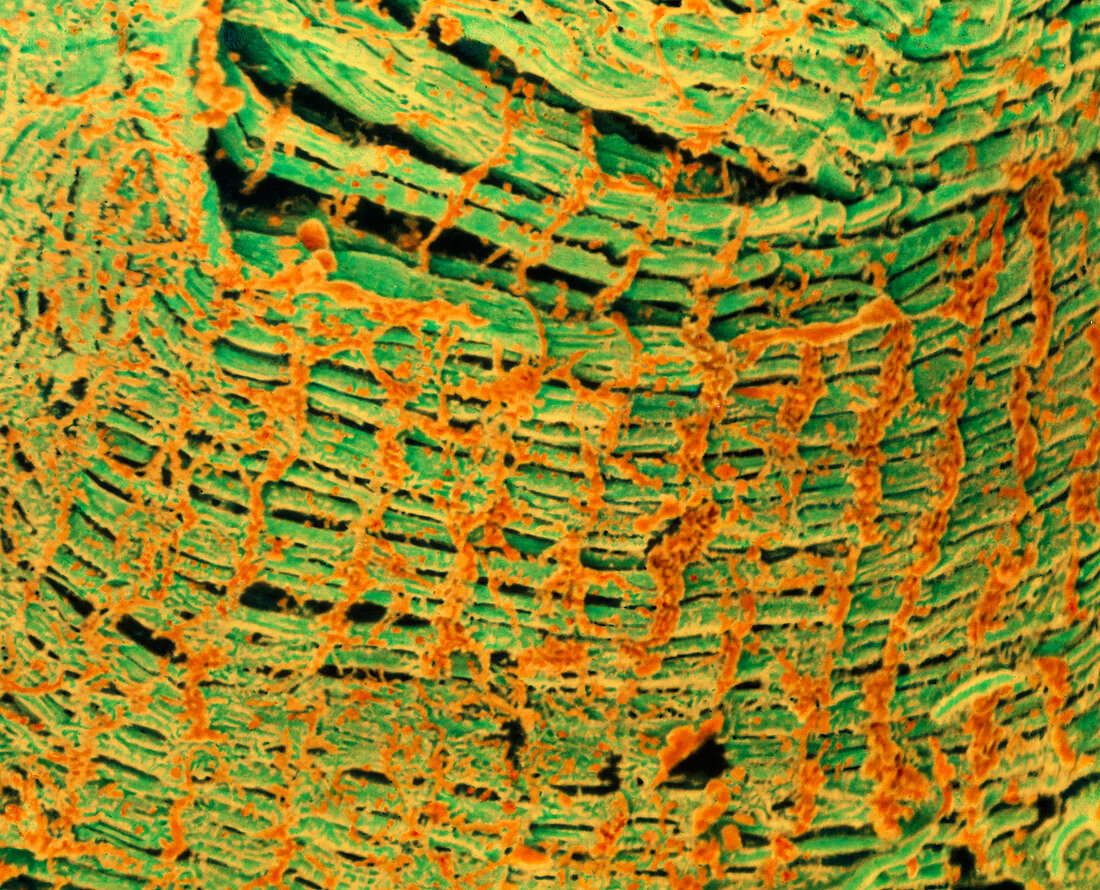 Coloured SEM of human striated muscle