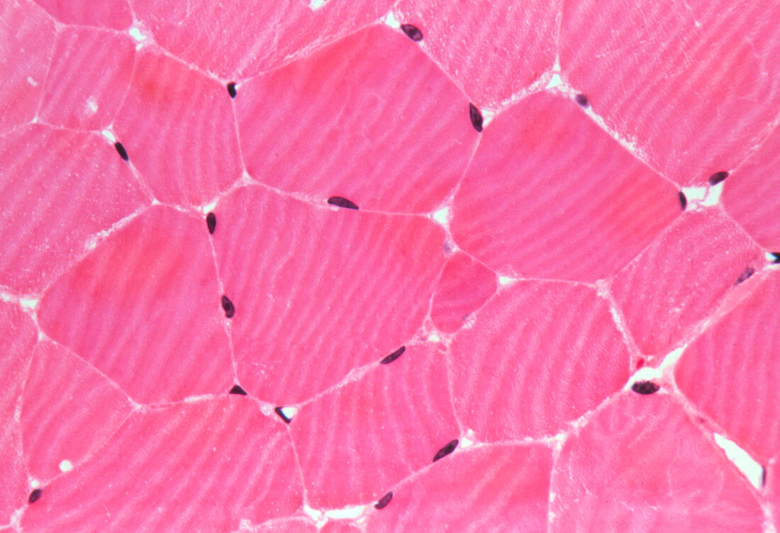 Skeletal muscle