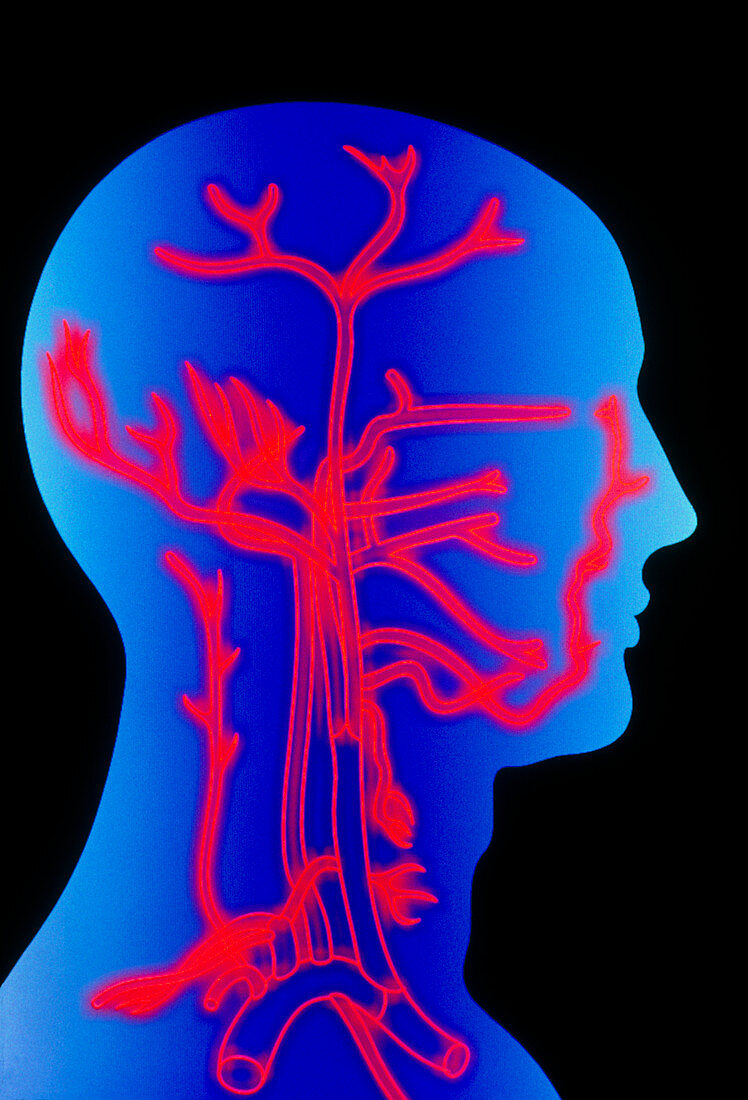 Computer graphic of head & neck,showing arteries