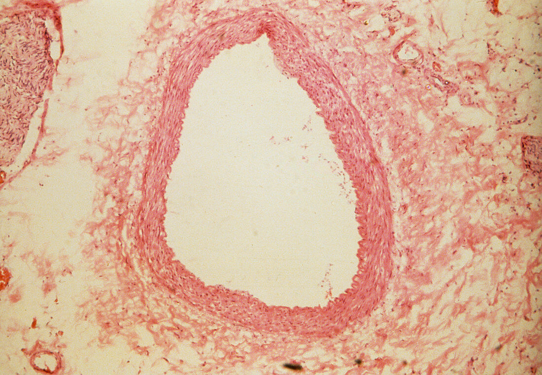 LM of a cross section of a human coronary artery