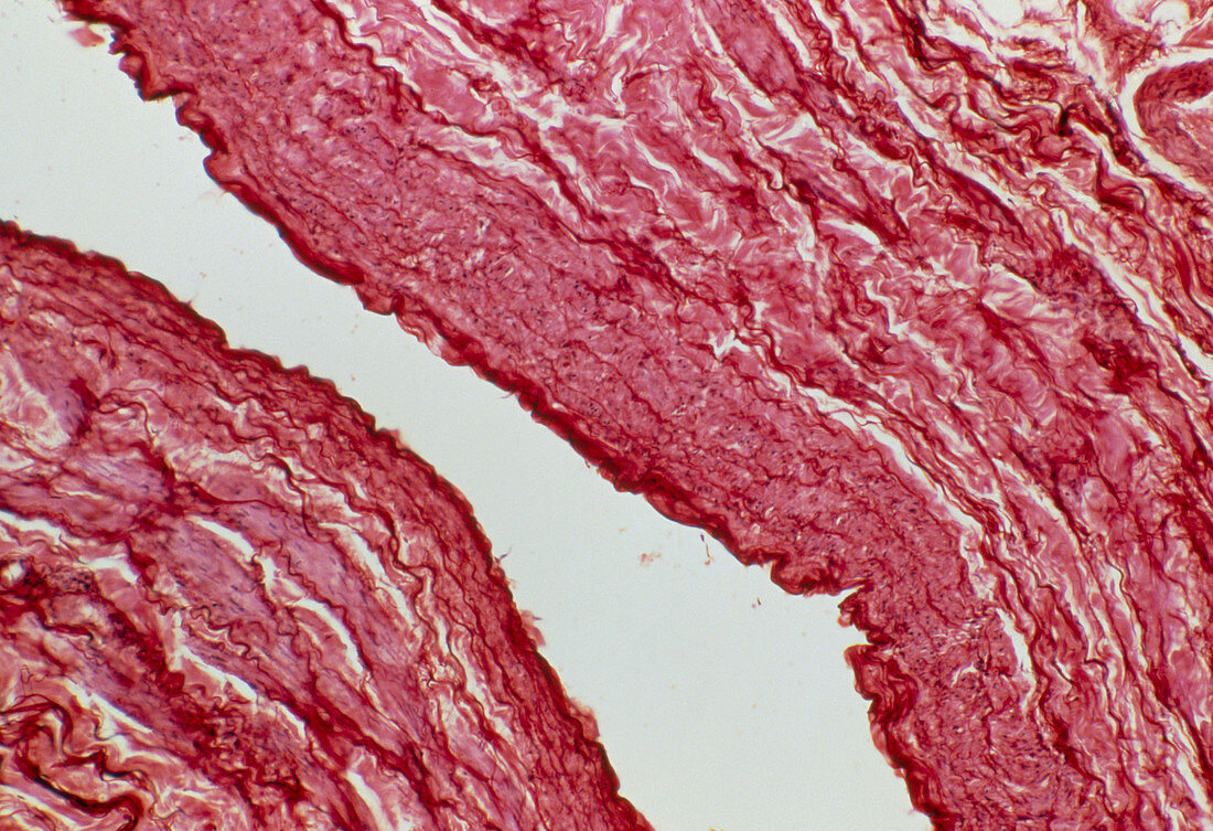 LM of a longitudinal section of a vein