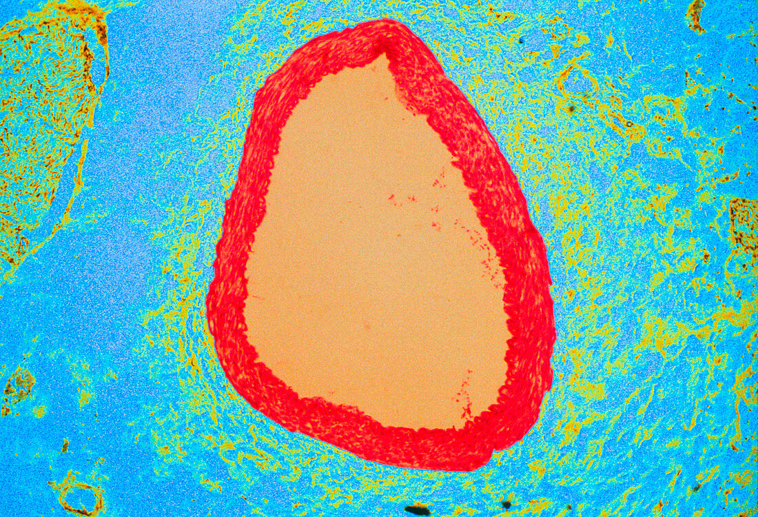 Coloured LM of a section through a coronary artery