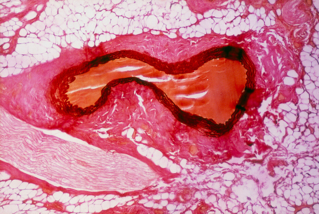 LM of a cross section through a small artery