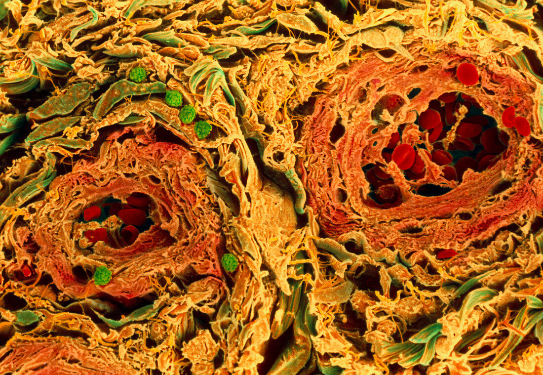 Coloured SEM of blood vessels in the skin