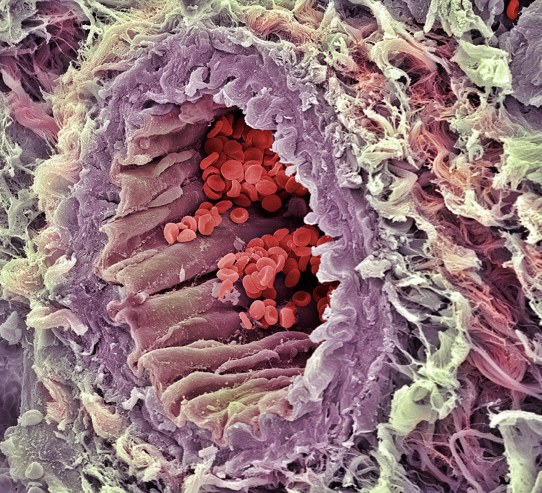 Artery SEM