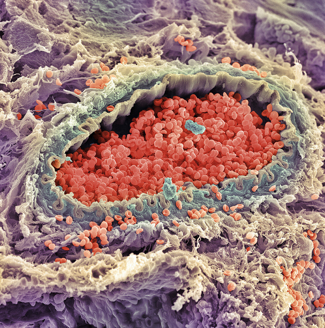 Artery SEM