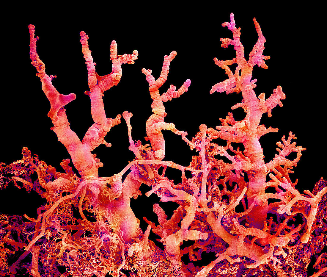 Blood vessels in a lung,SEM