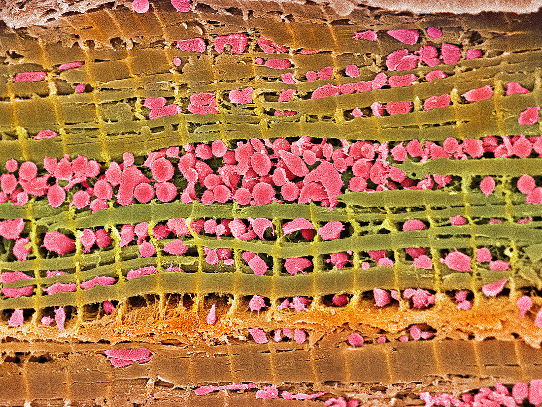 Cardiac muscle,SEM