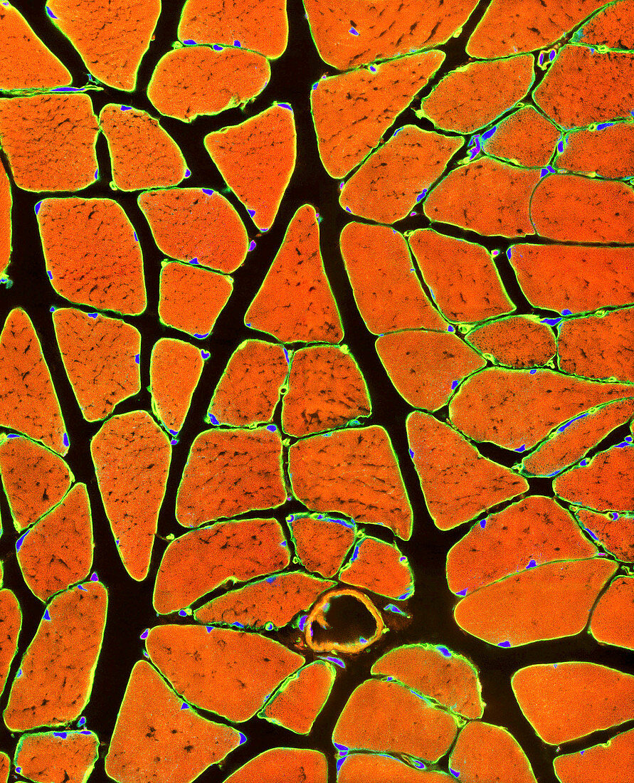 Skeletal muscle fibres,light micrograph