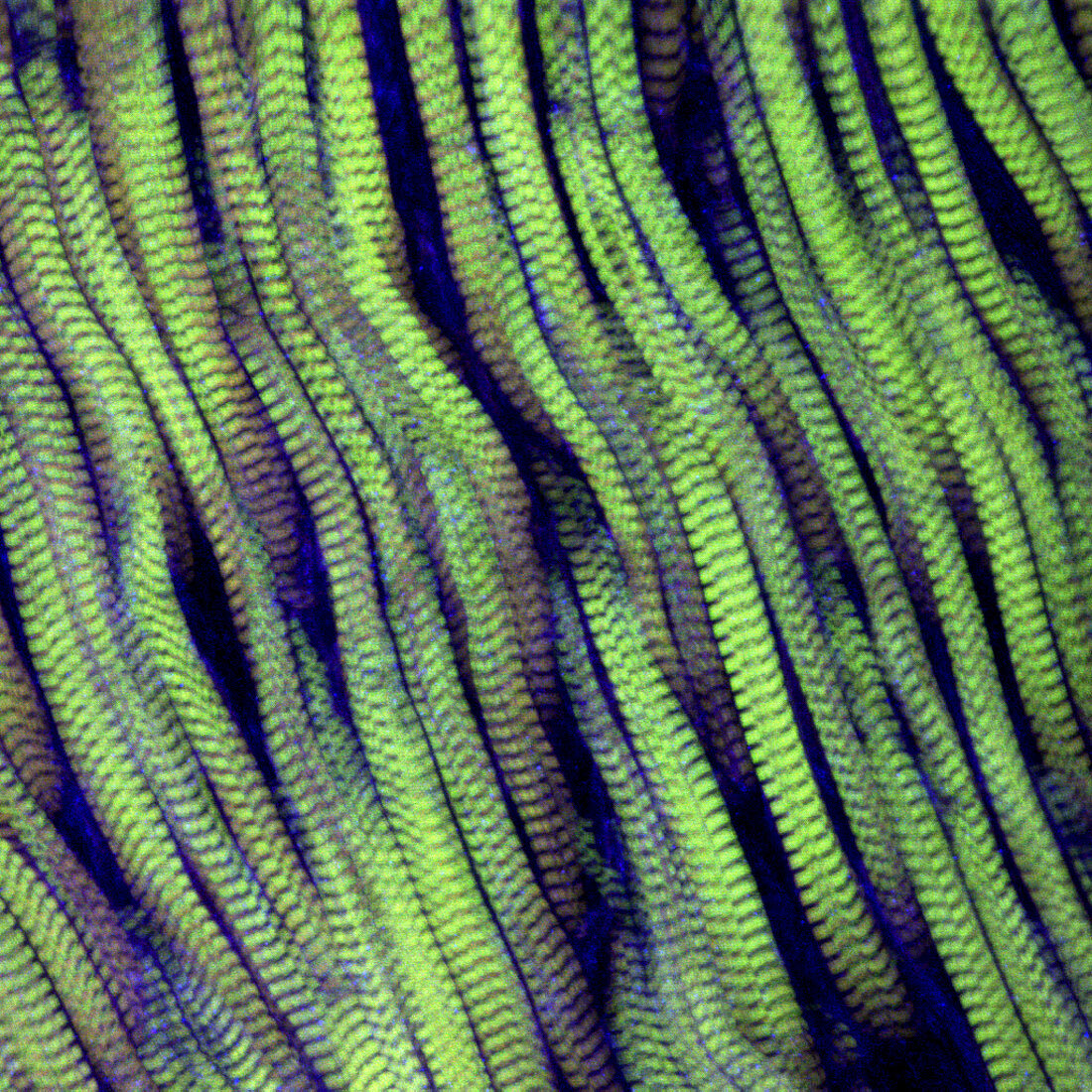 Muscle,fibres,light micrograph
