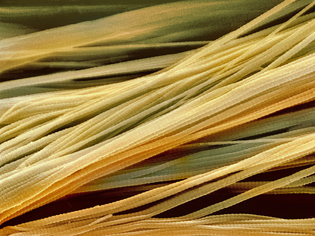 Tendon fibres,SEM