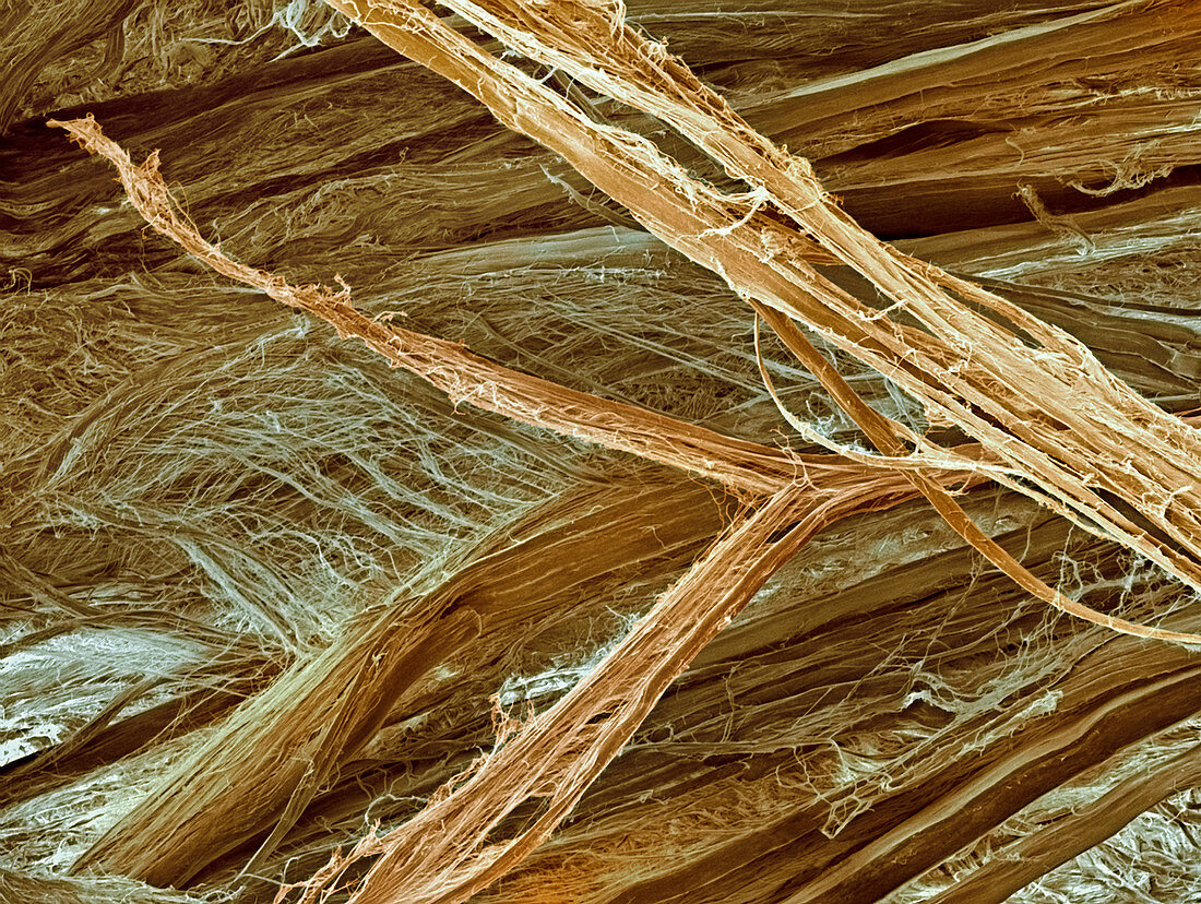 Tendon fibres,SEM