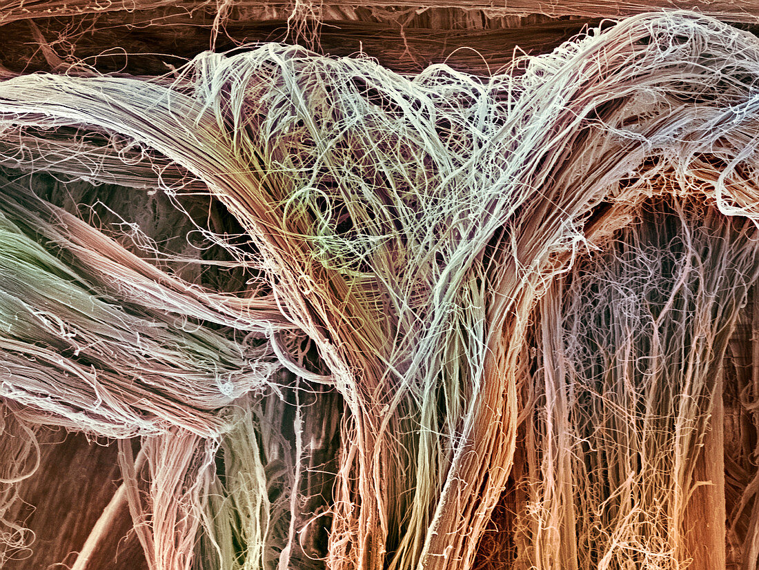 Tendon fibres,SEM