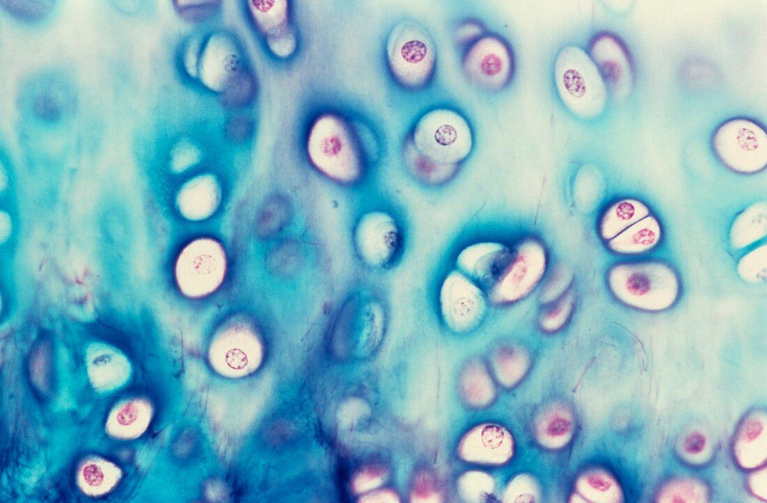 Hyaline cartilage,light micrograph