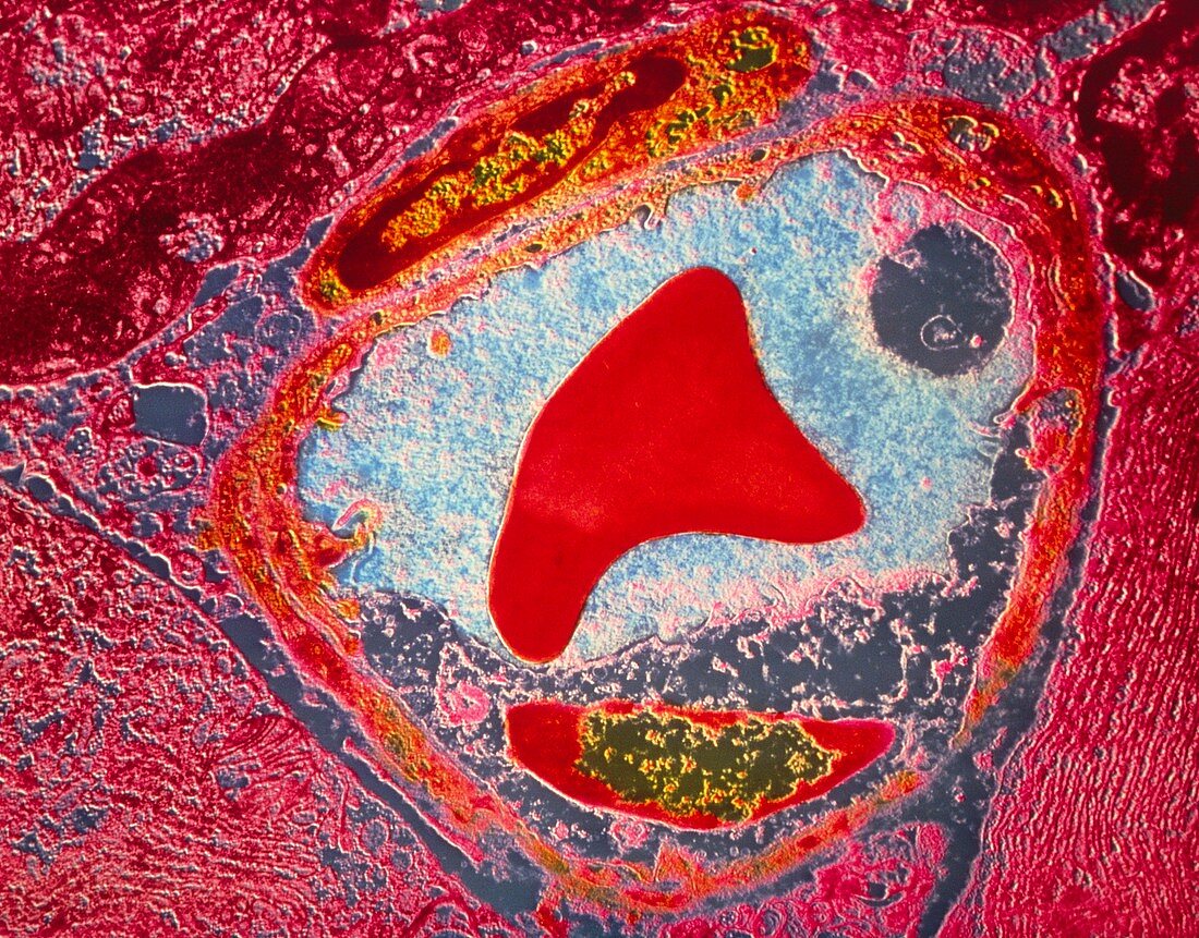 TEM of transverse section through blood capillary