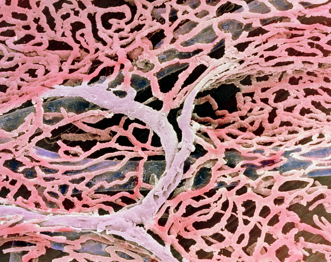 SEM of capillaries of the gall bladder