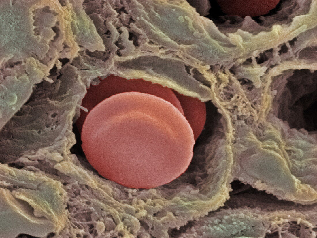 Capillary,SEM