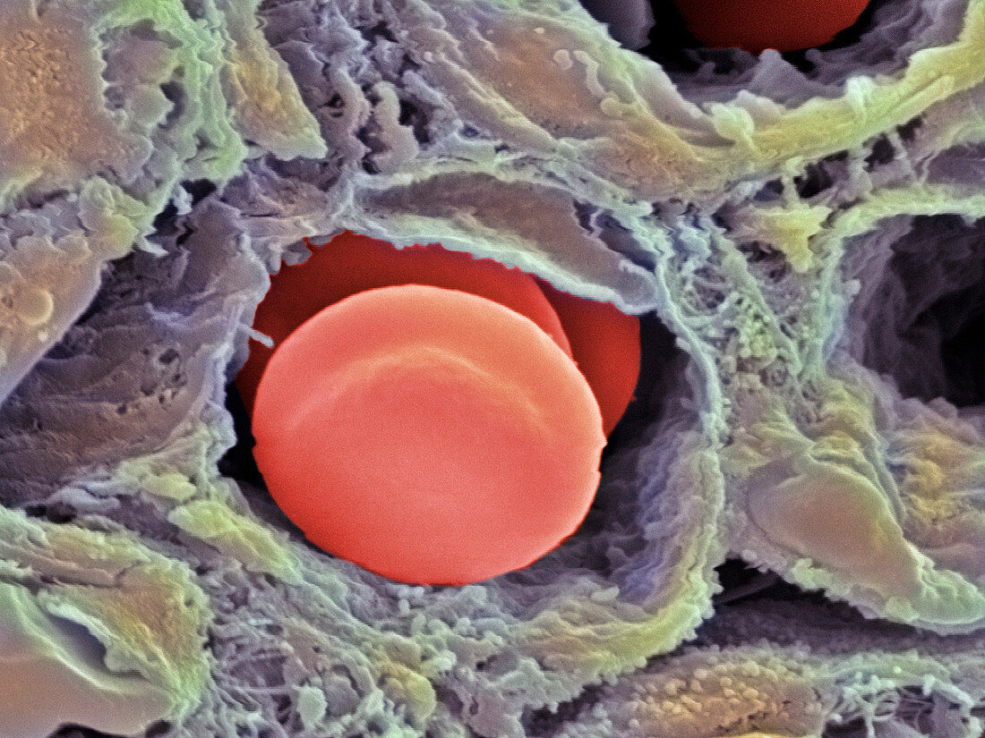 Capillary,SEM