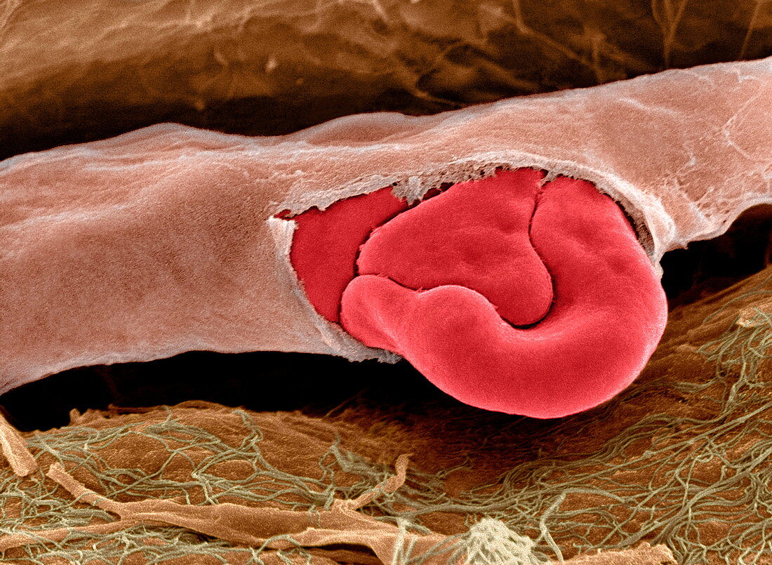 Ruptured capillary,SEM