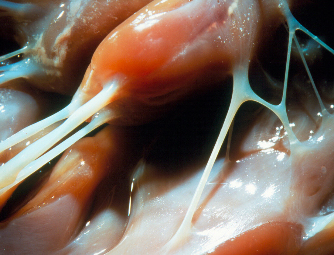 Macrophoto of tendon from a human heart ventricle