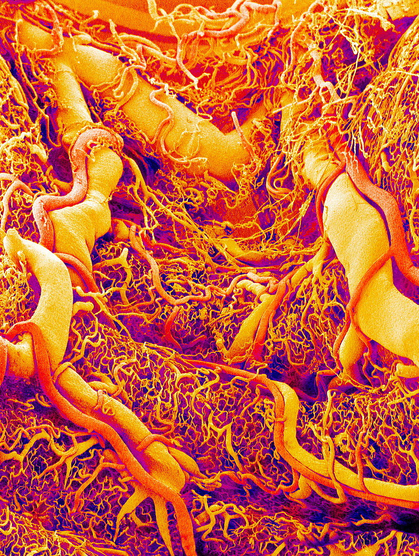 Blood vessels on a colon,SEM