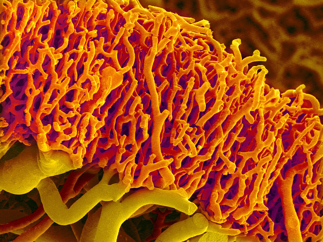 Blood vessels from the colon,SEM