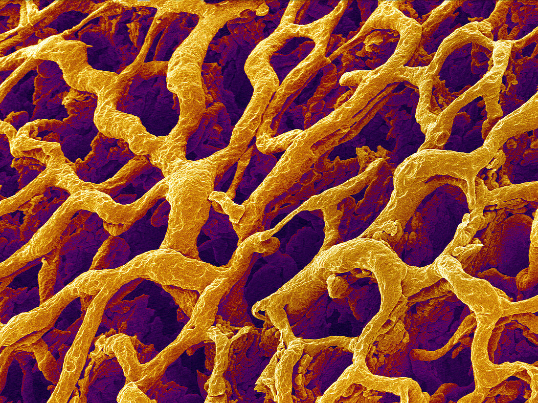 Blood vessels in the stomach wall,SEM