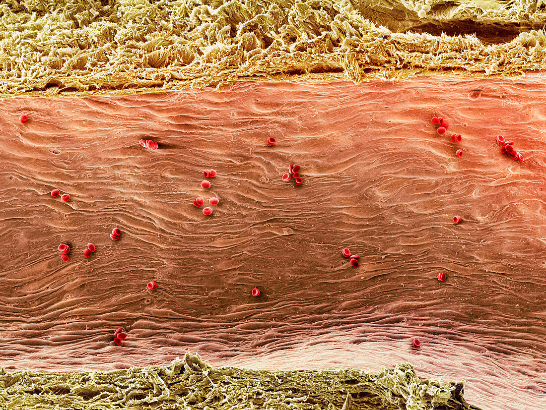 Ovarian blood vessel,SEM