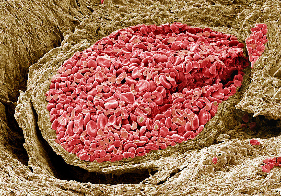 Foetal blood vessel,SEM