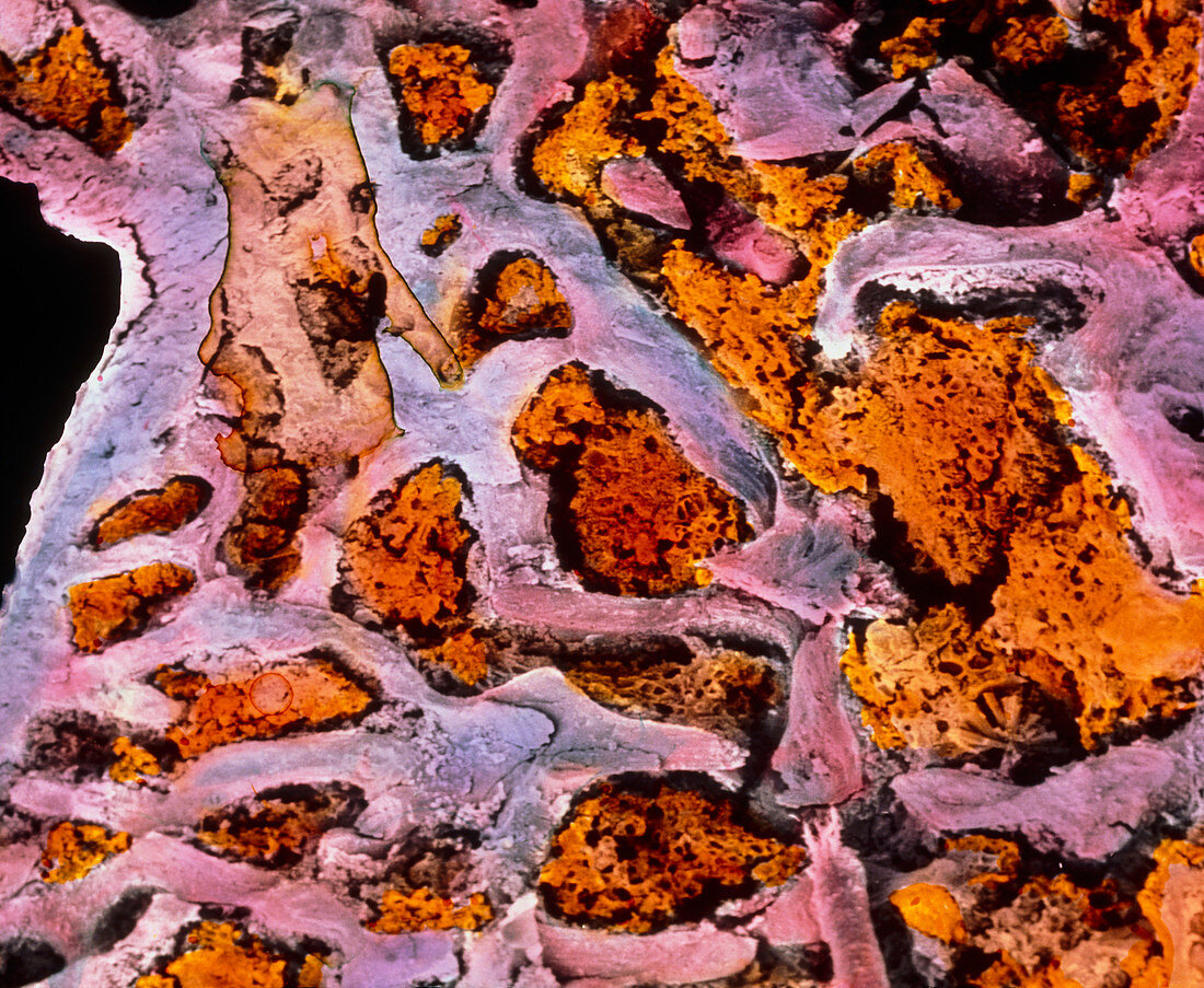Coloured SEM of bone marrow in spongy bone