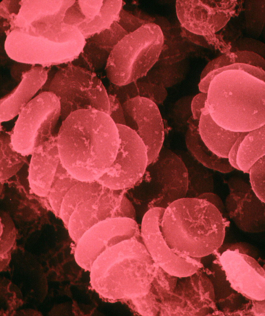 SEM showing red blood cells & fibrin filaments