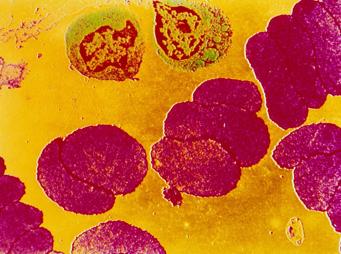 TEM of human blood showing red & white blood cells