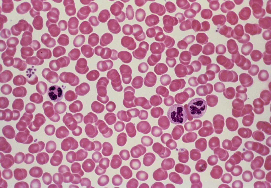 LM of human red blood cells & neutrophils