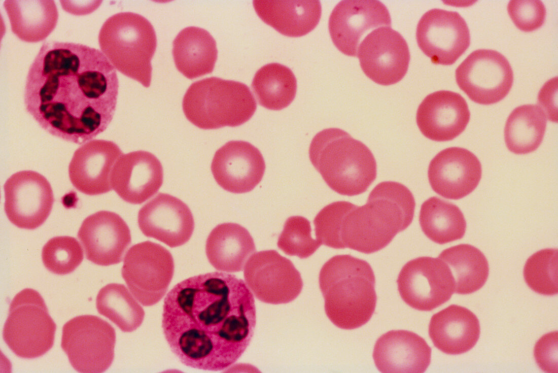 LM of human blood cells