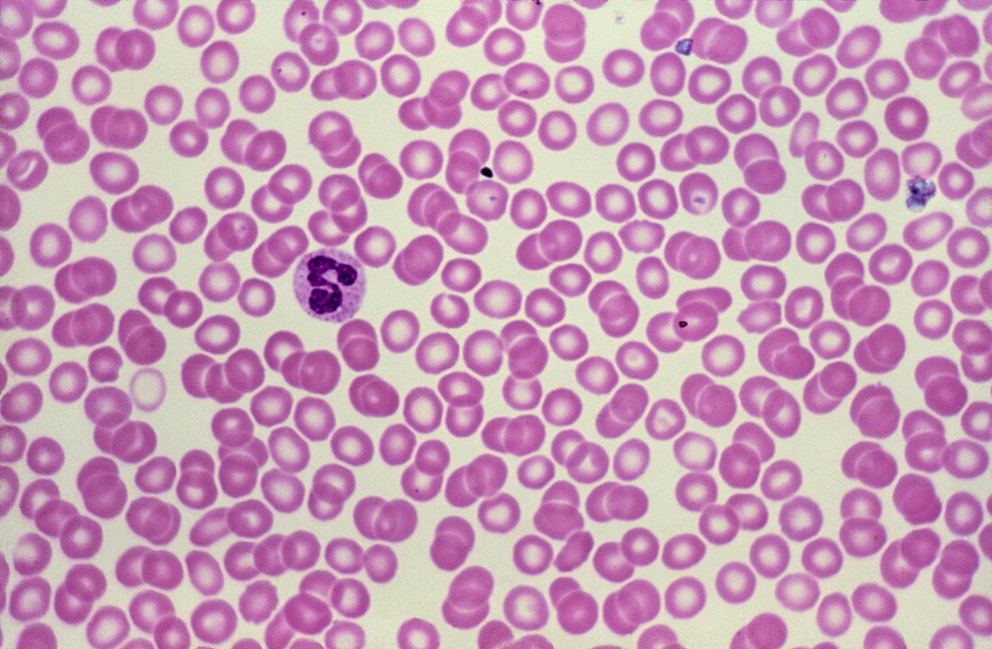 Human blood cells showing numerous red cells