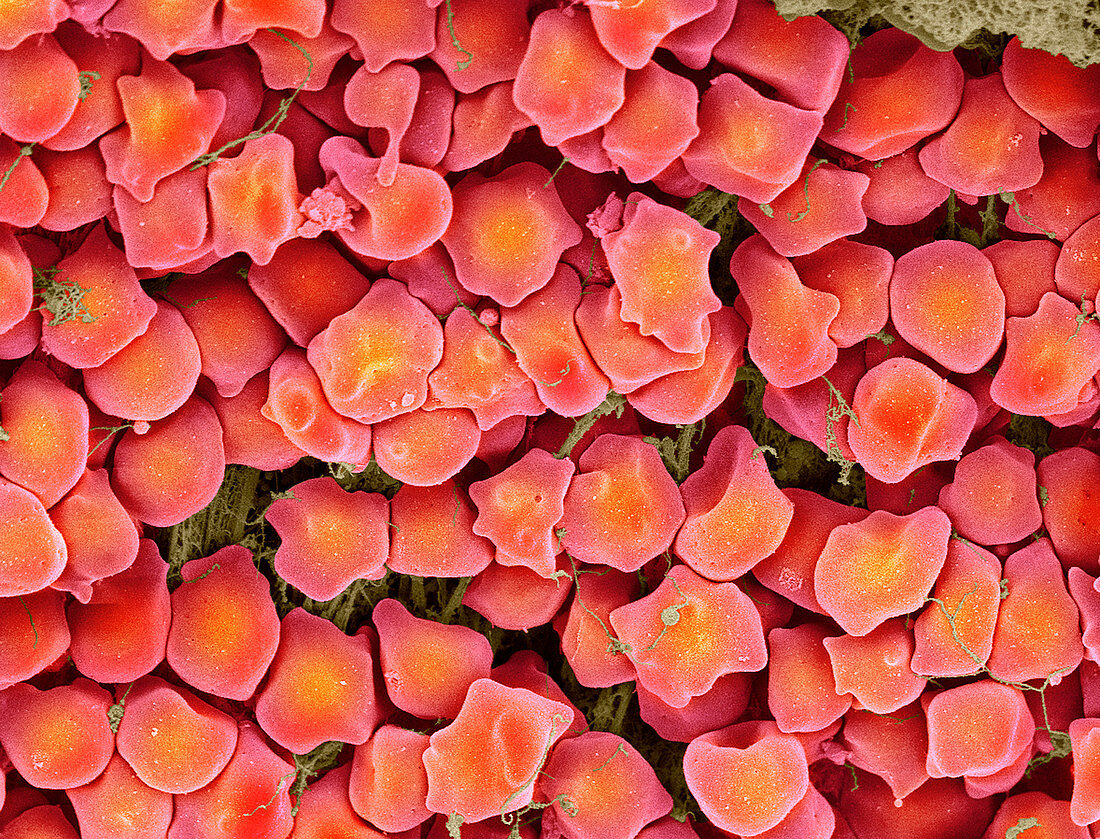 Foetal red blood cells,SEM