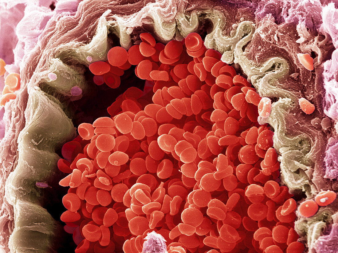 Red blood cells,SEM