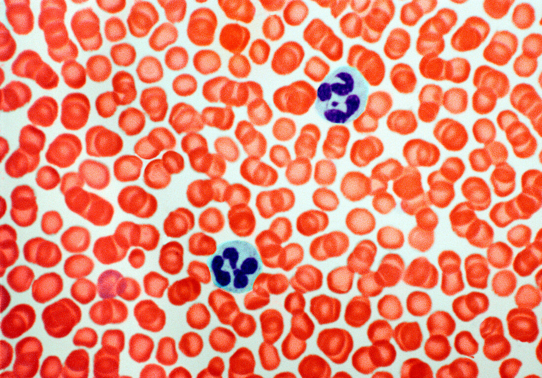 Human blood cells,light micrograph