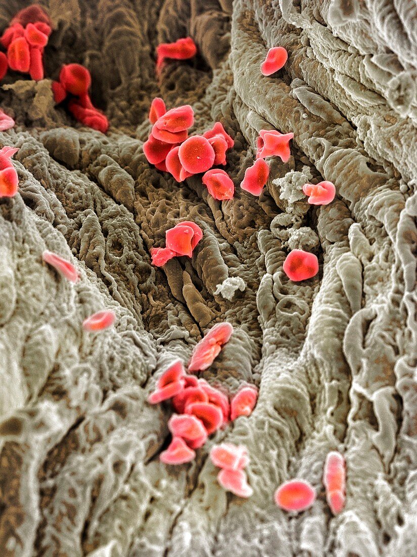 Red blood cells,SEM