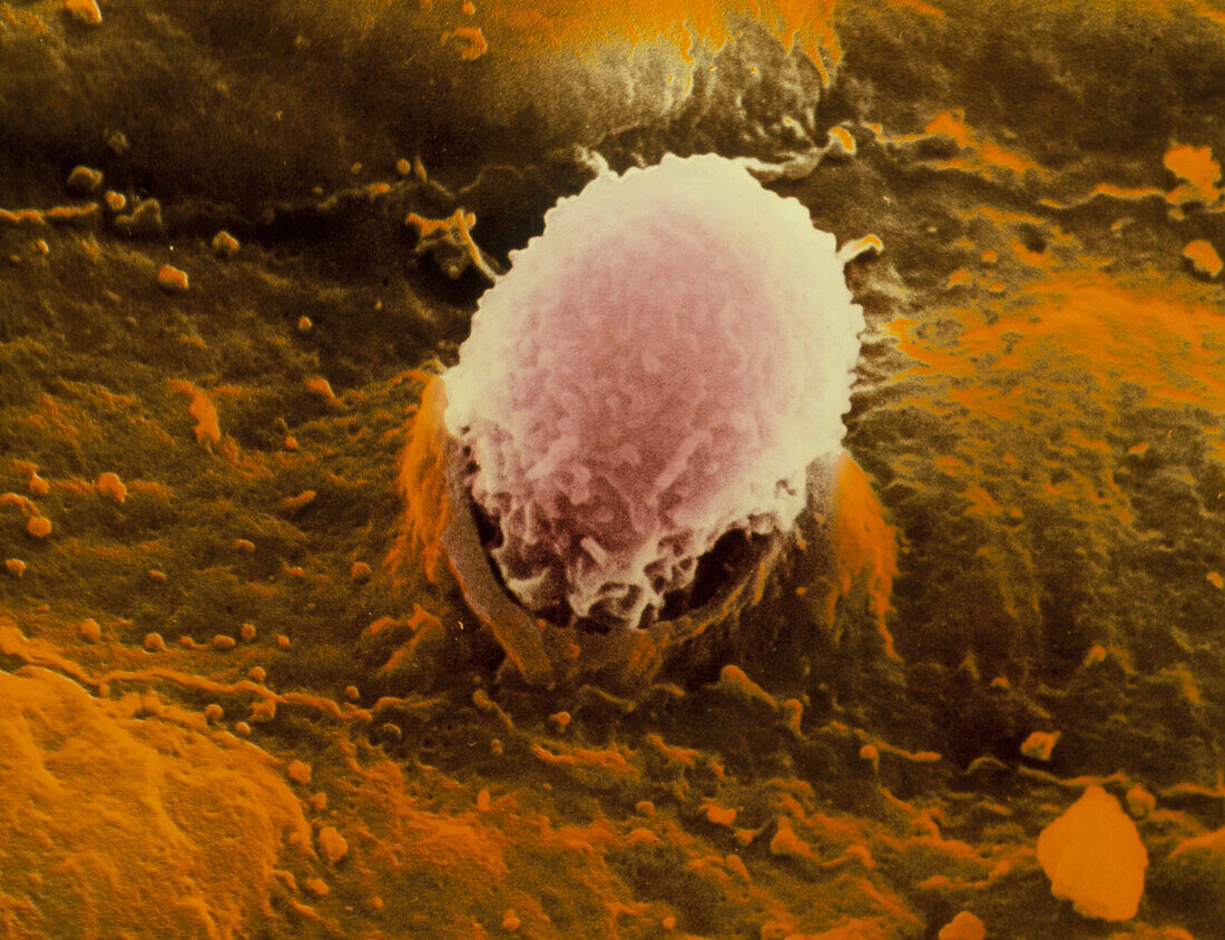SEM of white blood cell (leucocyte)