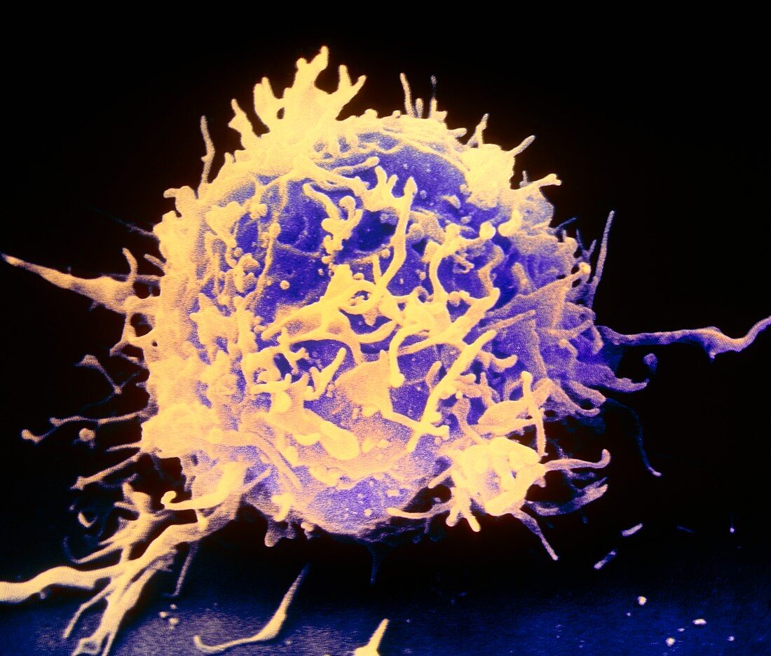 Coloured SEM of a T-lymphocyte white blood cell