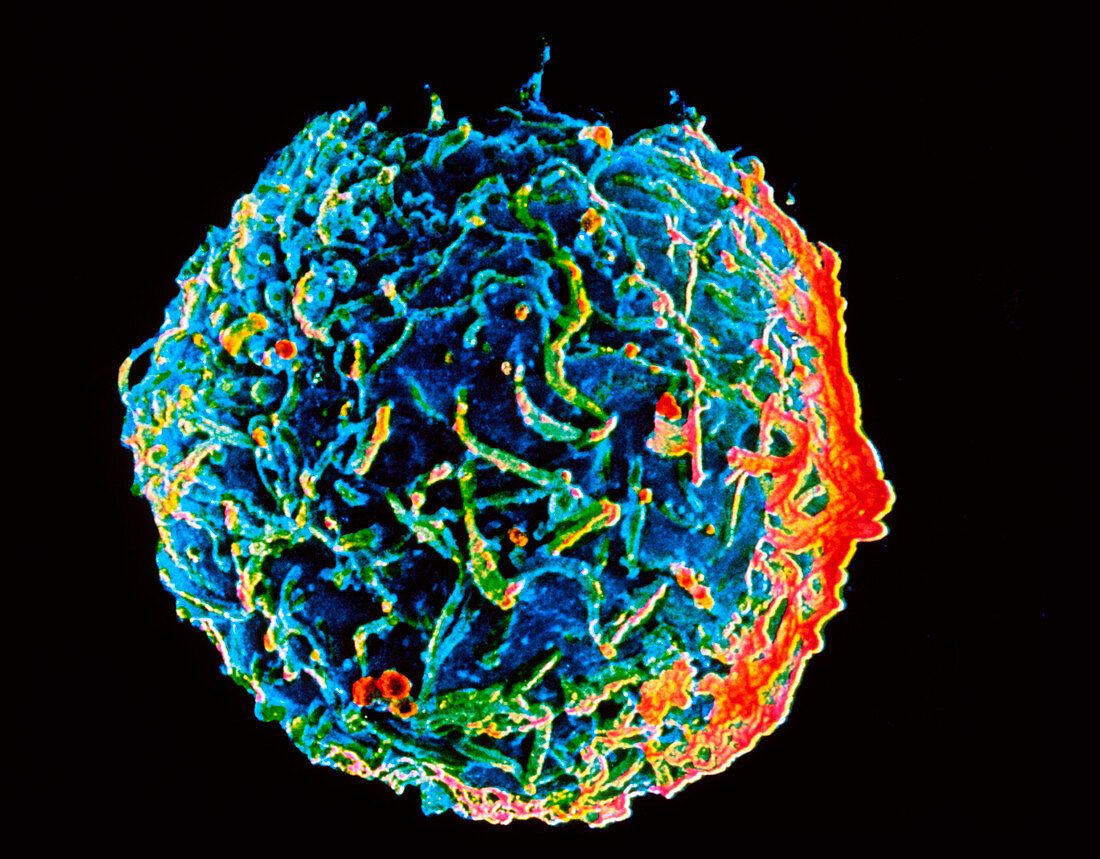 SEM of B-lymphocyte blood cell