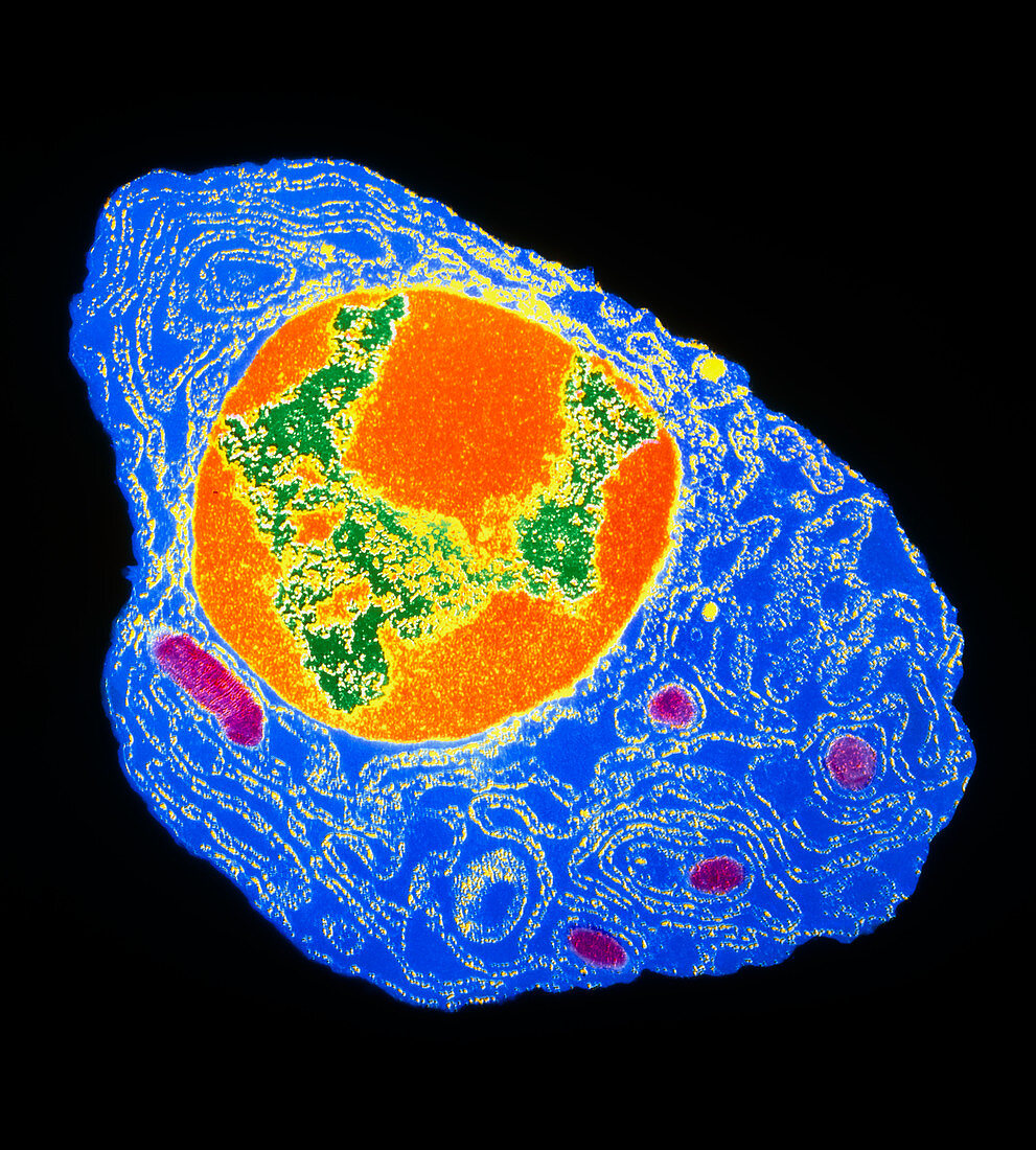 Coloured TEM of a plasma cell from bone marrow
