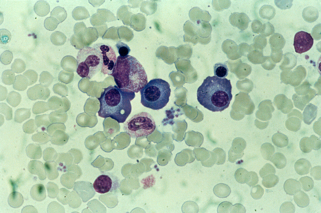LM of a blood smear showing white blood cells